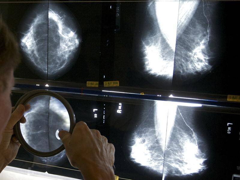 South Australia is the only state not to provide financial support for breast cancer patients.